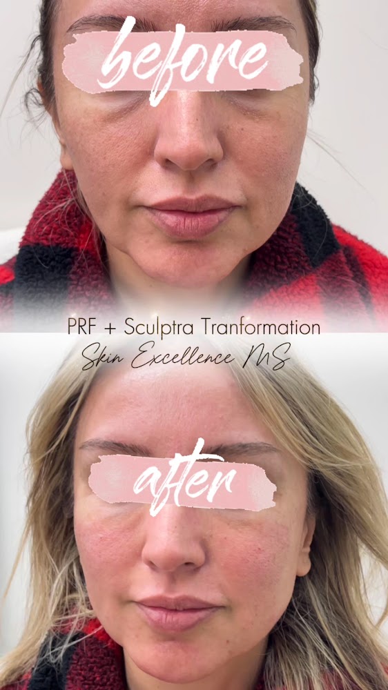 Skin Excellence Medspa