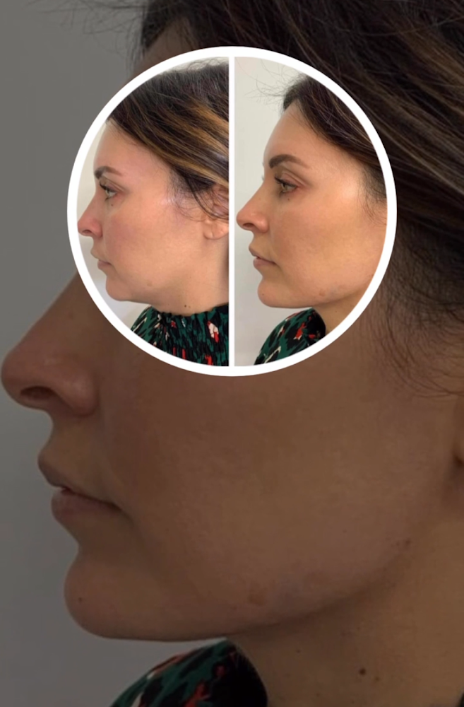 Richmond Hill Cosmetic Clinic LTD